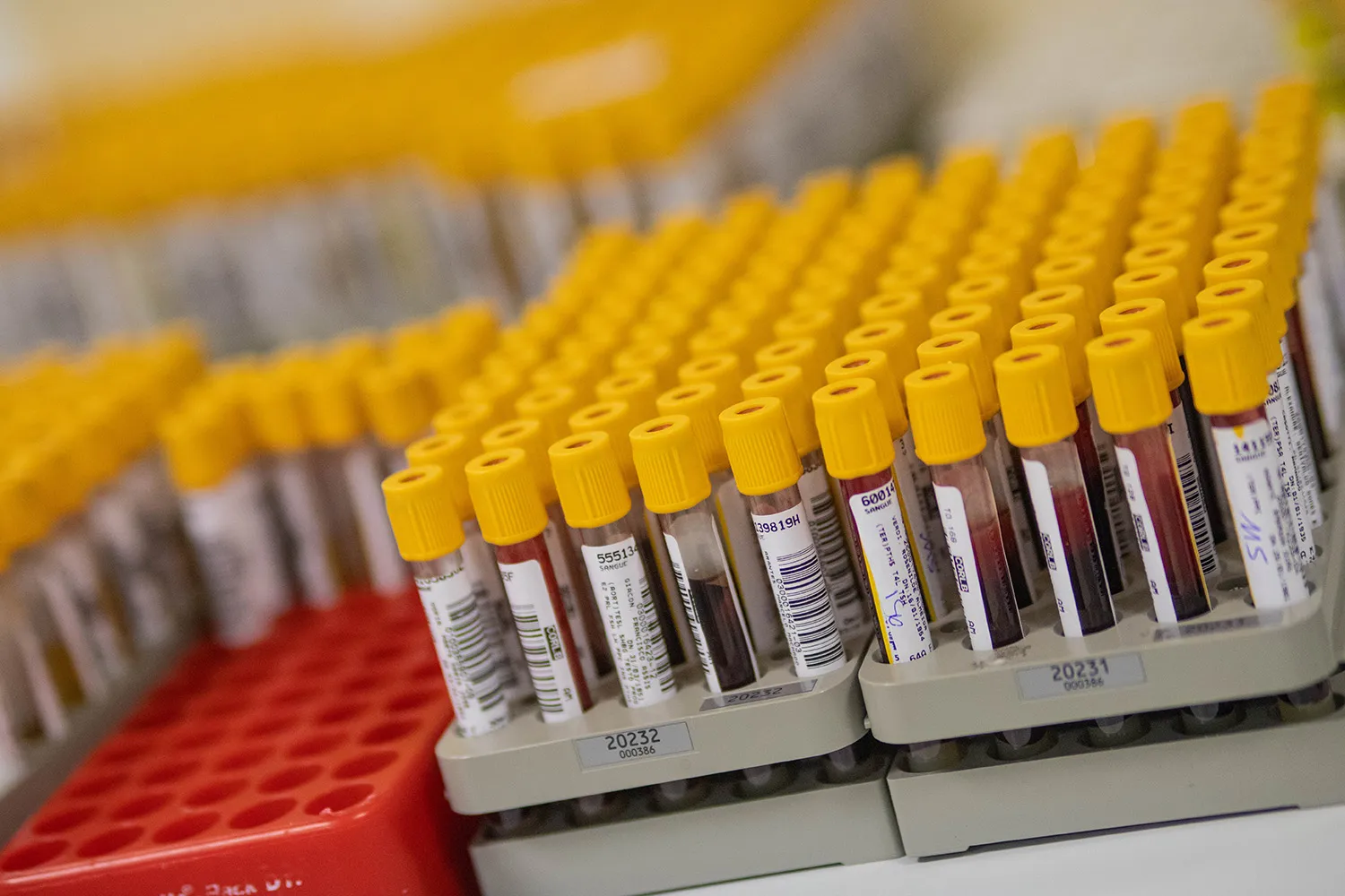 Decenas de tubos de muestras de sangre con tapón amarillo y etiquetas con código de barras, colocados en gradillas de laboratorio