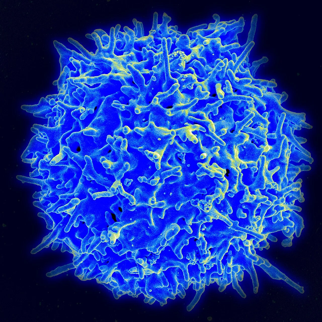 Un linfocito T humano visto al microscopio electrónico, en azul