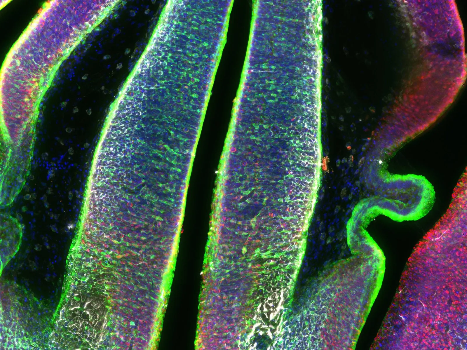 Imagen de microscopio con bandas de tejido cerebral en azul, rojo y violeta, bordeadas por líneas verdes fluorescentes